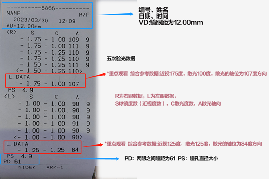 視力數(shù)據(jù)的含義。重慶普瑞眼科醫(yī)院供圖