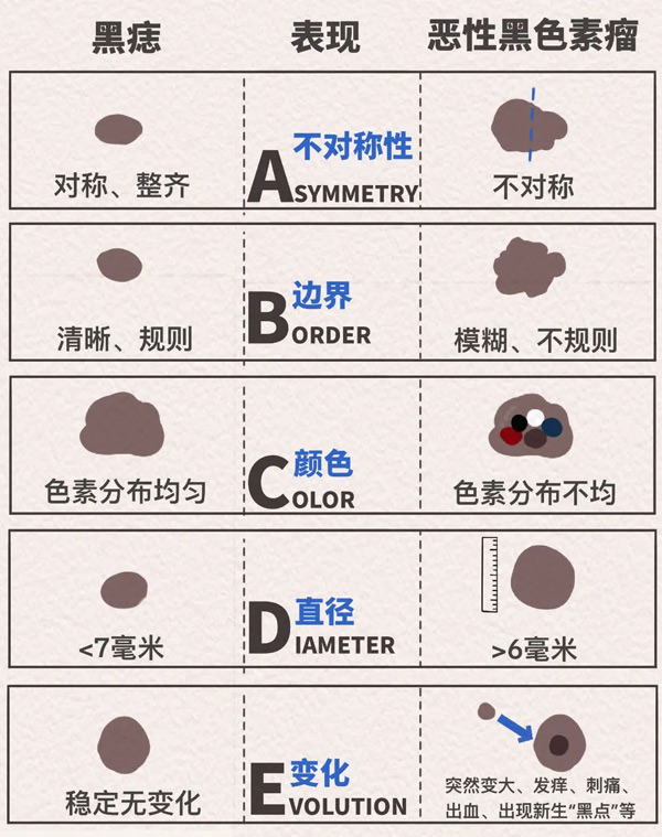 ABCDE法則示意圖。重慶松山醫(yī)院供圖