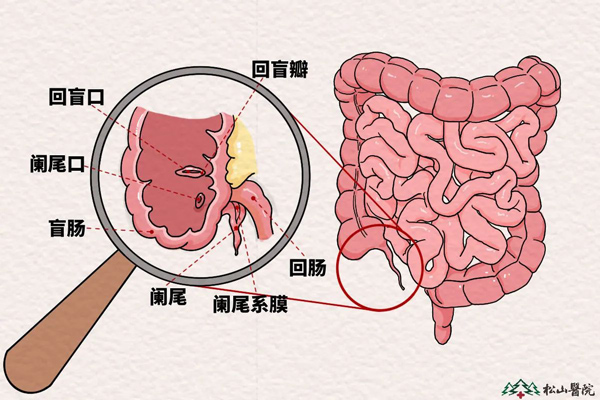 闌尾多余嗎？松山醫(yī)院：闌尾還有這些用處